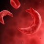 On Sickle Cell Day, NGOs seek mandatory genotype screening of newborns